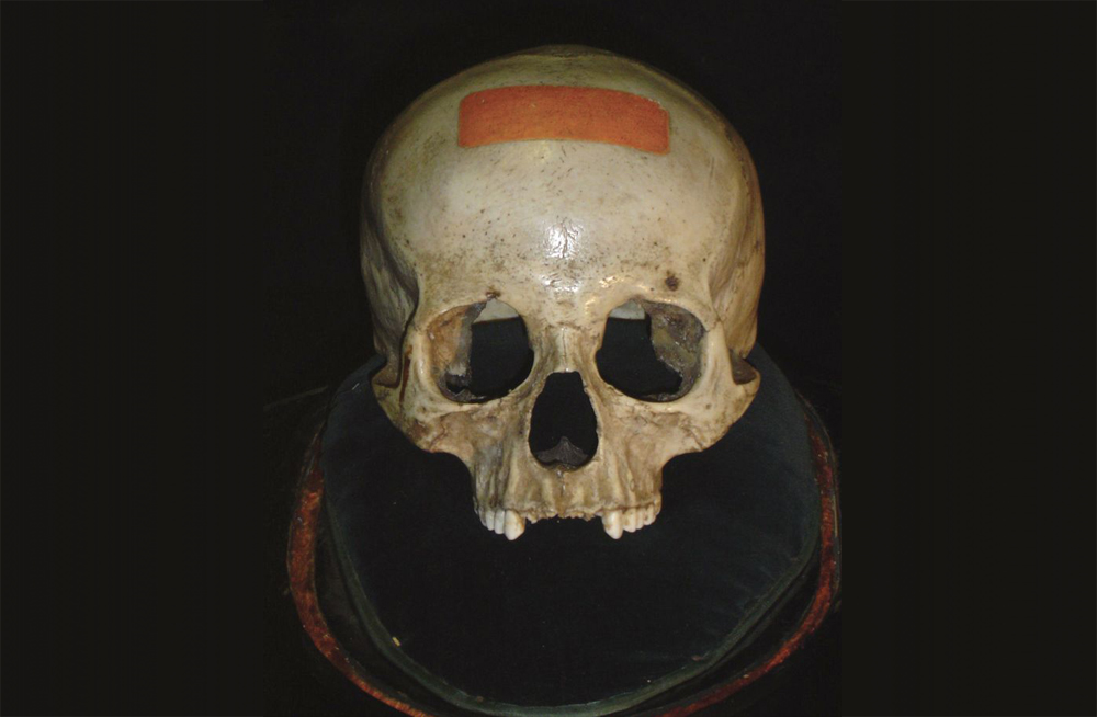 mozart's skull